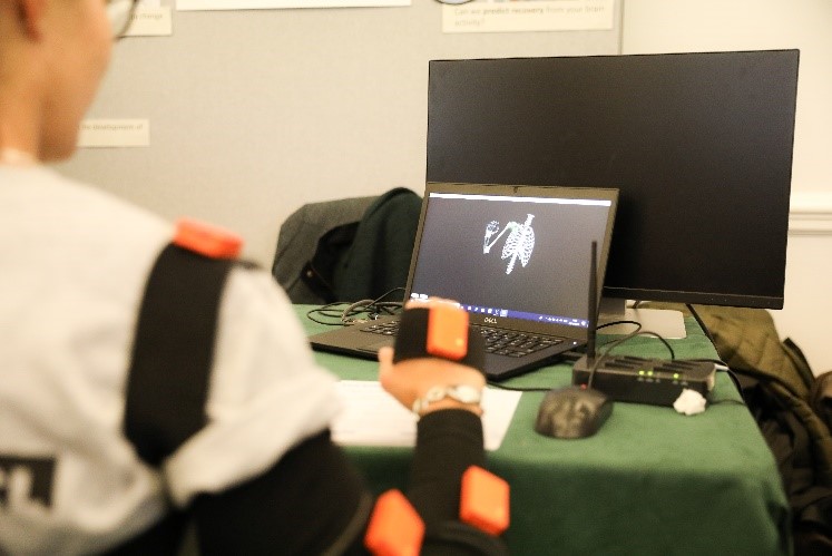 Free, digital Forum brings stroke patients and researchers together in an online space image