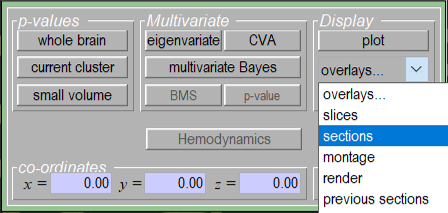 Screenshot of the Sections drop-down in SPM