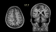 clinneurophysiol