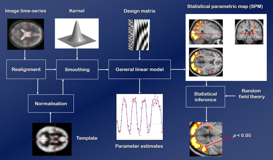 Statistical Parametric Mapping